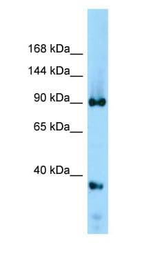 DDX20 / GEMIN3 Antibody (aa651-700)