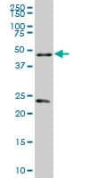 Monoclonal Mouse anti-Human RXTA / RXR-Alpha Antibody (clone 4D6, WB)
