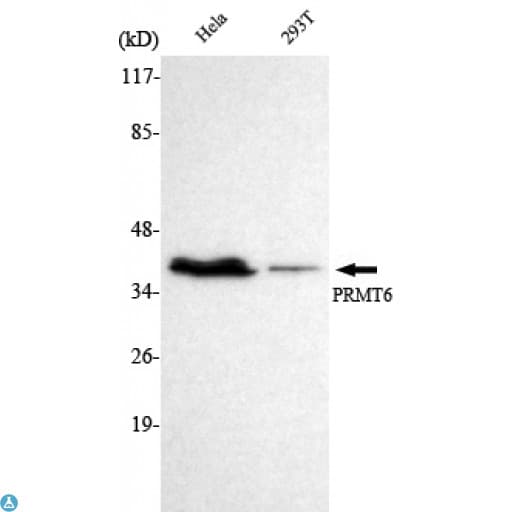 PRMT6 Antibody