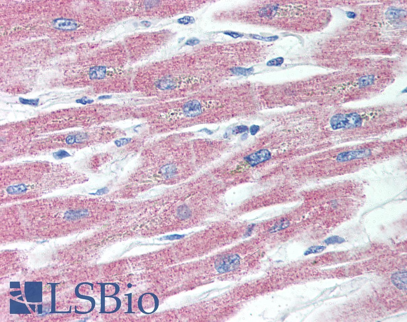 IHC-plus™ TNFRSF11A / RANK Antibody (aa326-616, clone 9A725)