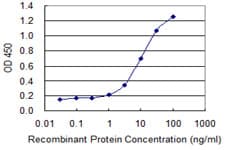 IHC-plus™ CACNA2D2 Antibody (clone 3A4)