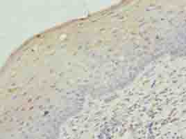 LRRC18 Antibody