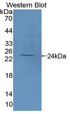 TS / Thromboxane Synthase Antibody (aa357-533, HRP)