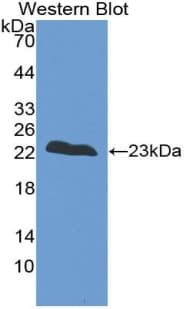 TNNI2 Antibody (aa1-182)