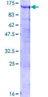 Human BCAS3 Protein (Recombinant GST)