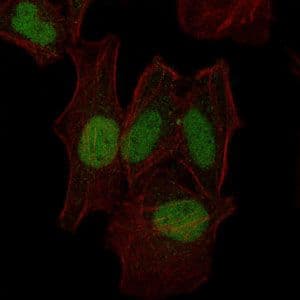 Monoclonal Mouse anti-Human MAP2K7 / MEK7 Antibody (clone 400000, IHC, IF, WB)