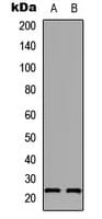 AANAT Antibody (Internal)