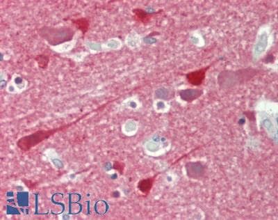 IHC-plus™ STMN1 / Stathmin / LAG Antibody (aa9-58)