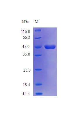 Human Neuroserpin Protein (Recombinant)