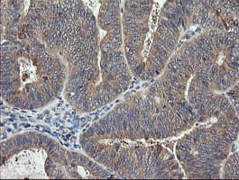 TCL / RHOJ Antibody (clone OTI2C9)