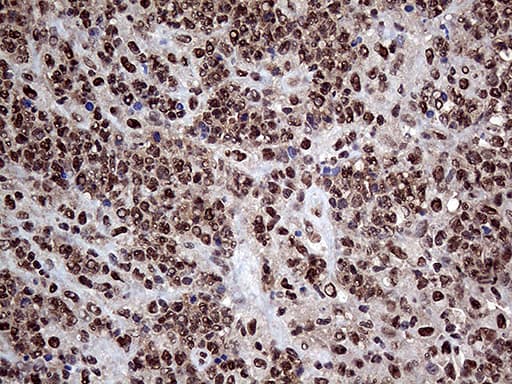 Monoclonal Mouse anti-Human PPP4C Antibody (clone OTI2E4, Carrier-free, IHC, WB)