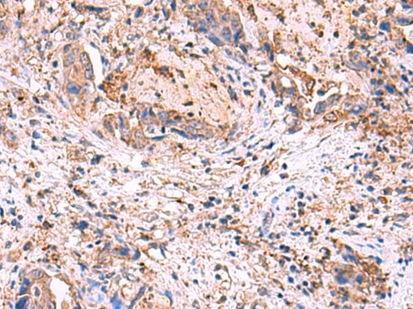 Polyclonal Rabbit anti-Human MPP1 Antibody (IHC)