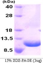 Human MIP2 / GRO2 / CXCL2 Protein (Recombinant His)