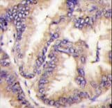 Polyclonal Rabbit anti-Human STK9 / CDKL5 Antibody (aa982-1012, IHC, WB)