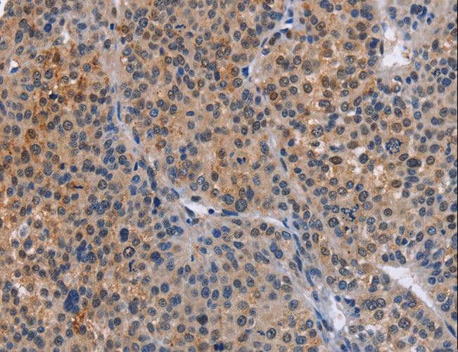 MAP3K13 / LZK Antibody