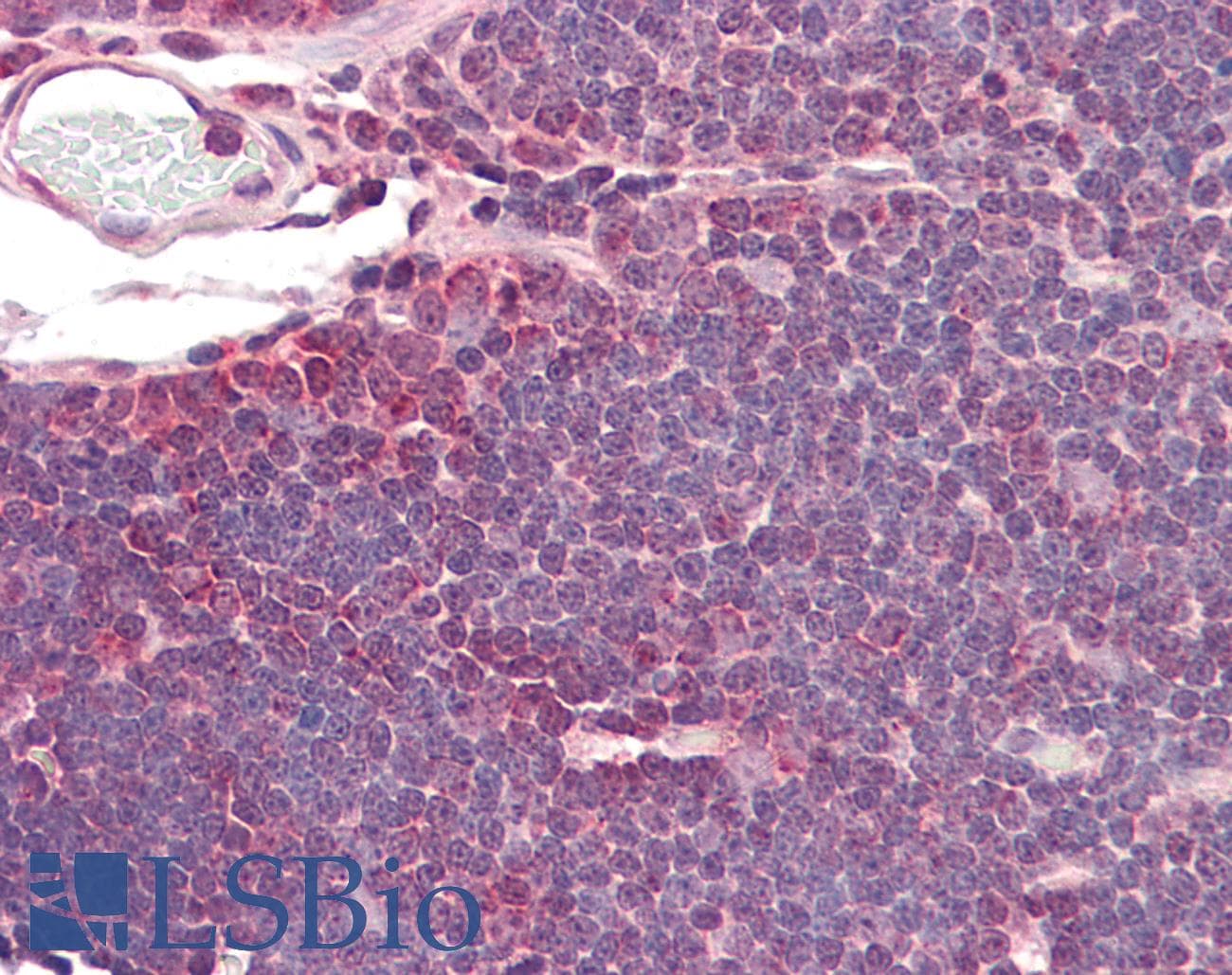 IHC-plus™ Polyclonal Goat anti-Human IDH3A Antibody (aa353-366, IHC, WB)