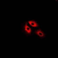 MDH / MDH2 Antibody