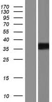 PRSS21 / Testisin Protein (Over-Expression Lysate Myc-DDK (Flag))