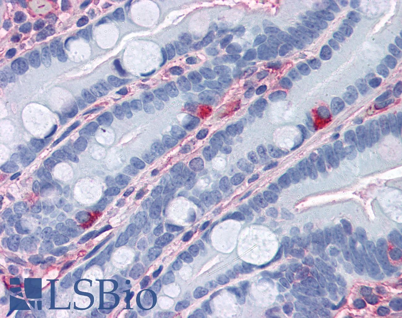 IHC-plus™ APOA1 / Apolipoprotein A 1 Antibody (clone 057-10029)