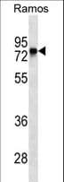 Monoclonal Mouse anti-Human BTK Antibody (aa209-239, WB)