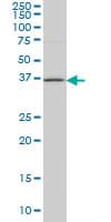 Monoclonal Mouse anti-Human HSD17 / HSD17B1 Antibody (clone 2E5, WB)