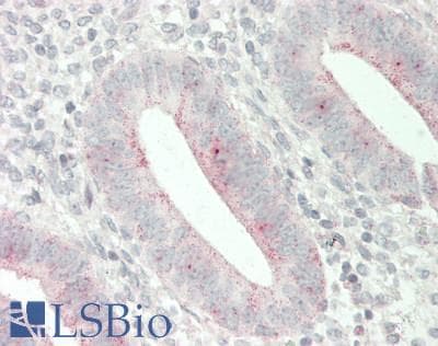 IHC-plus™ CHP2 Antibody (Internal)