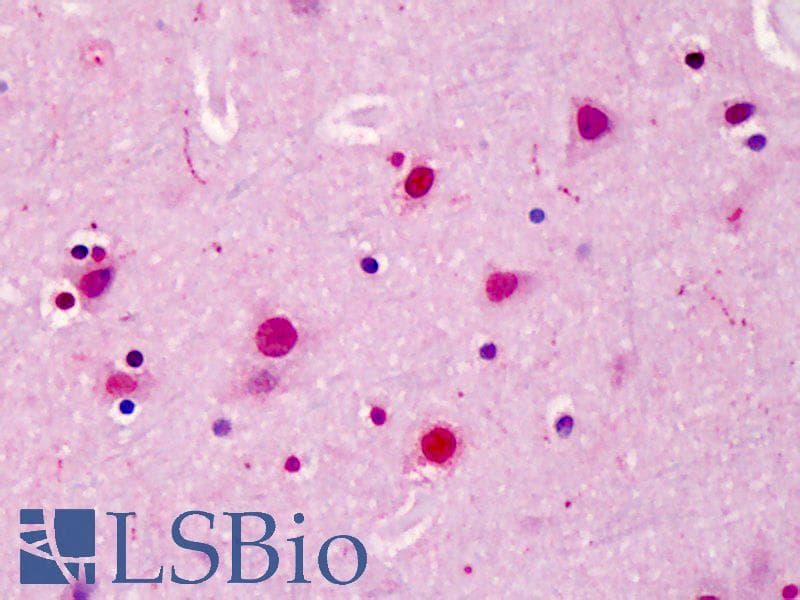 IHC-plus™ Polyclonal Rabbit anti-Human SATB2 Antibody (IHC, IF, WB)