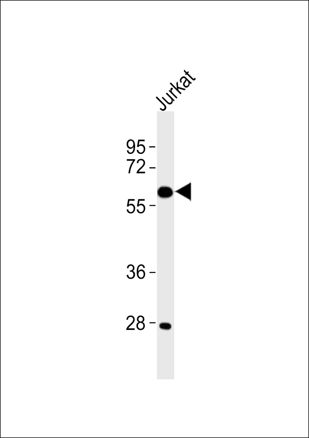 CYP4X1 Antibody