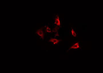 ACTBL2 Antibody