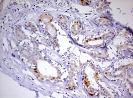PR / Progesterone Receptor Antibody (aa1-298, clone OTI6E3)