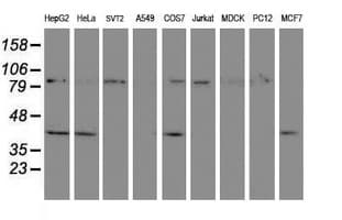 CRYZL1 Antibody (clone OTI2F9)