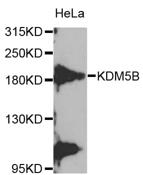 Polyclonal Rabbit anti-Human KDM5B / JARID1B Antibody (WB)