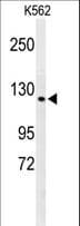 IHC-plus™ CTC1 Antibody (aa767-795)