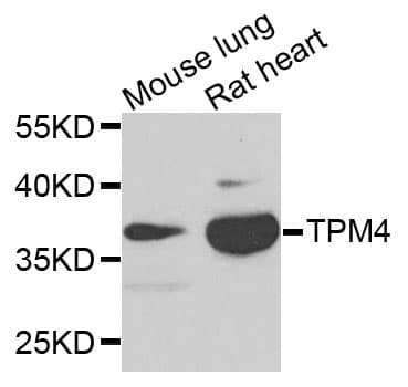 TPM4 Antibody