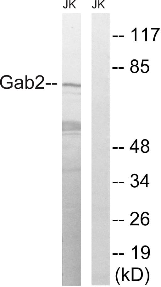GAB2 Antibody (aa589-638)