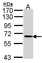 Polyclonal Rabbit anti-Human MINPP1 Antibody (aa246-487, IHC, WB)