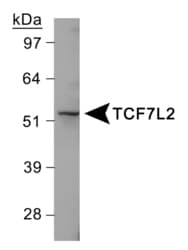TCF7L2 / TCG4 Antibody (Internal)