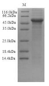 Human TXNIP Protein (Recombinant 6His-B2M, N-terminus)