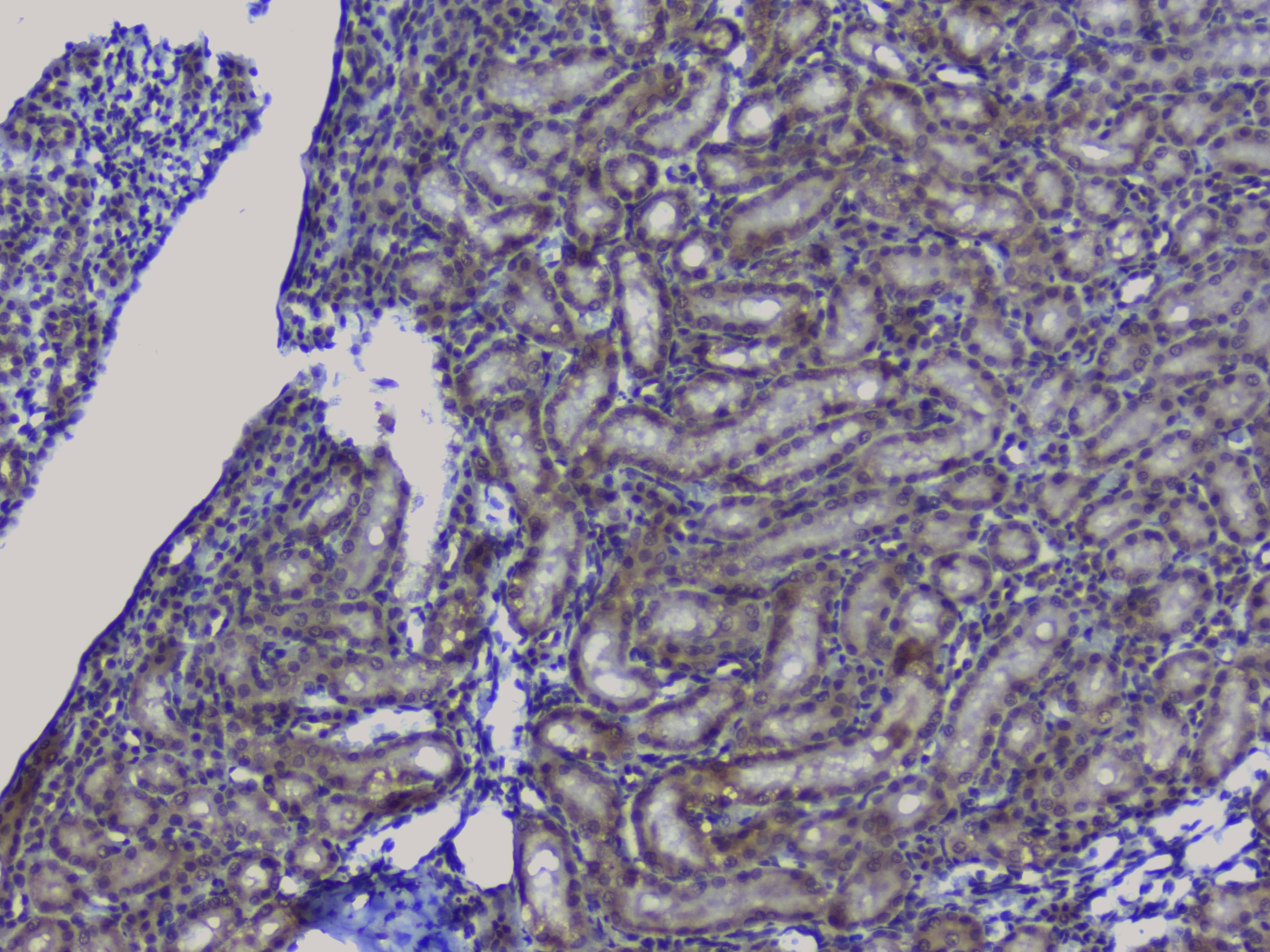 NRF1 / NRF-1 Antibody