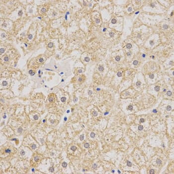 MUSK Antibody