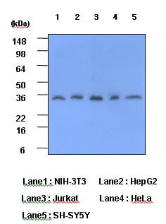 Monoclonal Mouse anti-Human CRP / C-Reactive Protein Antibody (clone 5A9, aa19-224, WB)