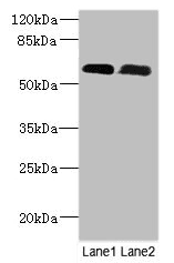 Polyclonal Rabbit anti-Human PNPLA1 Antibody