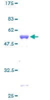 Human TAZ Protein (Recombinant GST, N-terminus)