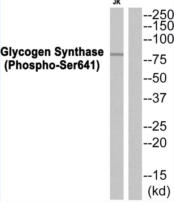 Polyclonal Rabbit anti-Human GYS1 / Glycogen Synthase Antibody (phospho-Ser641, WB)