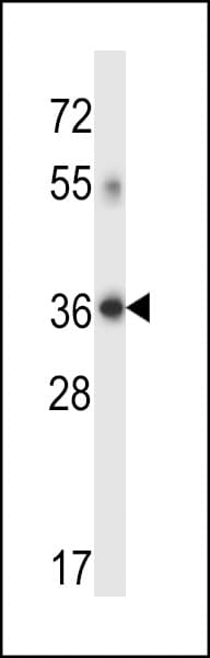 Polyclonal Rabbit anti-Human DHRS7C Antibody (aa116-145, IHC, WB)
