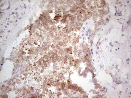 Monoclonal Mouse anti-Human NEFM / NF-M Antibody (clone OTI5B7, aa413-773, IHC, WB)