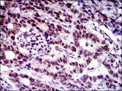 CFLAR / FLIP Antibody (aa100-251, clone 6G11A6)