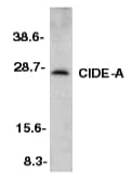 Polyclonal Rabbit anti-Human CIDEA / CIDE-A Antibody (IHC, IF, WB)