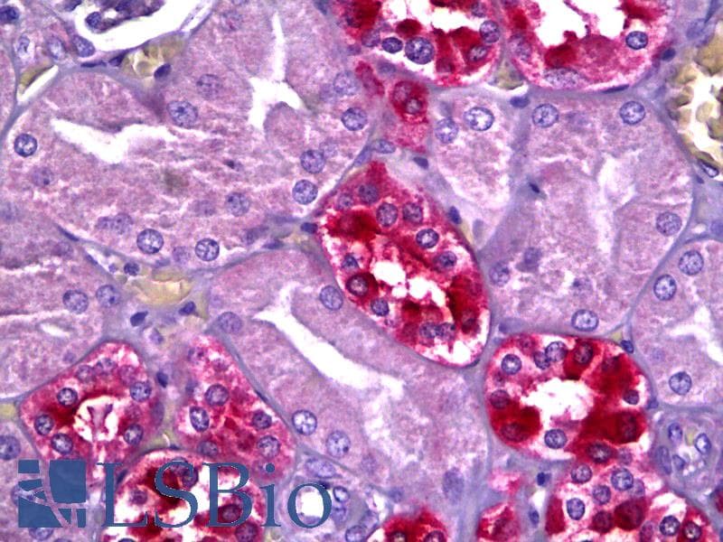 IHC-plus™ Polyclonal Rabbit anti-Human PHLPP2 / PHLPPL Antibody (C-Terminus, IHC, WB)