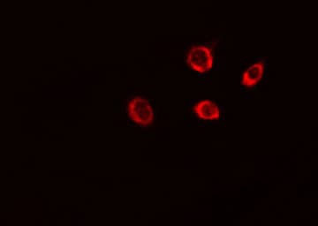 Polyclonal Rabbit anti-Human PEX5 Antibody (IF, WB)